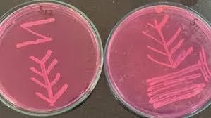 Estados Unidos: La leche cruda puede contener bacterias resistentes a antibióticos, alerta nuevo estudio científico